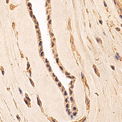 sars-cov-2 gene expression in a human fetus